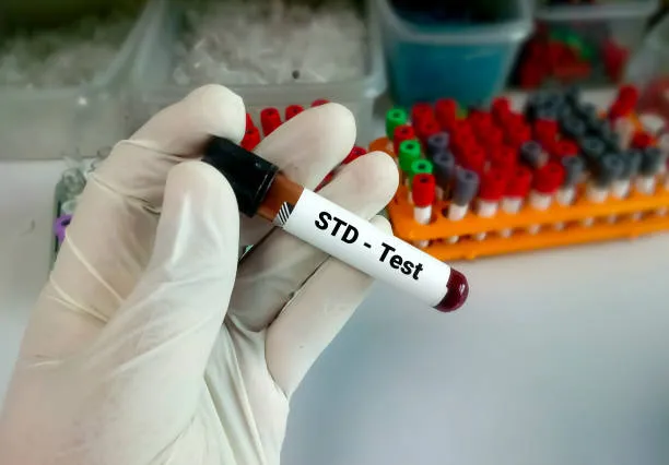 ПК Клиническая лабораторная диагностика СПИДа, инфекционных болезней, включая оценку иммунного статуса 144ч