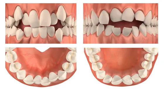 ПК Аномалии и деформации зубов и зубных рядов. Современные методы ортодонтического лечения 36ч