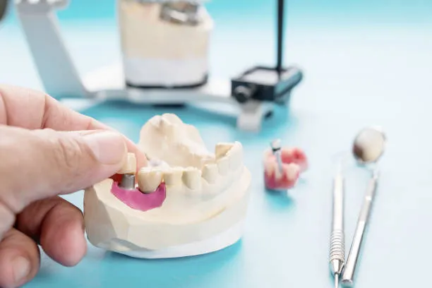 ПК Современные технологии протезирования при частичном отсутствии зубов 18ч